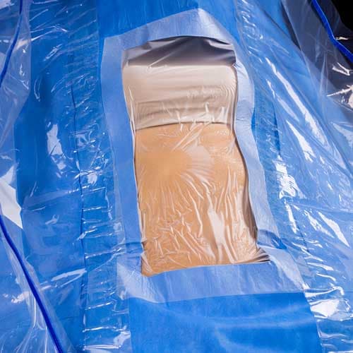 PAÑOS QUIRÚRGICOS PARA LA LAPAROTOMÍA